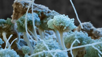 Color-enhanced scanning electron micrograph of the fungus Aspergillus nidulans shows fungal growths that look like broccoli clusters